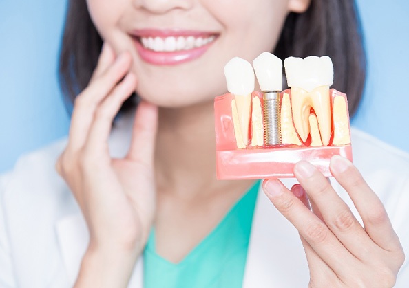 Dentist holding a model that shows how dental implants work in Powell