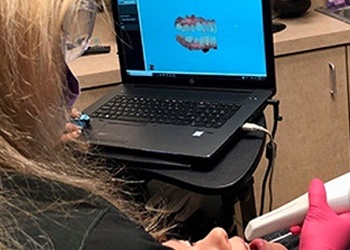 A digital impression of a patient’s oral cavity appearing on a laptop for the dentist to view