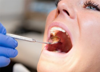 Closeup of patient during dental exam