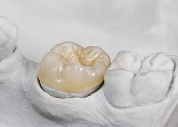 Model smile with dental crown