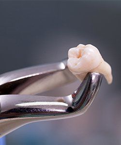 Metal clasp holding extracted tooth