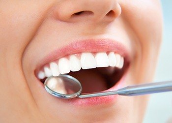 Closeup of healthy smile